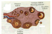 IVF is a very popular method these days that is helping childless 